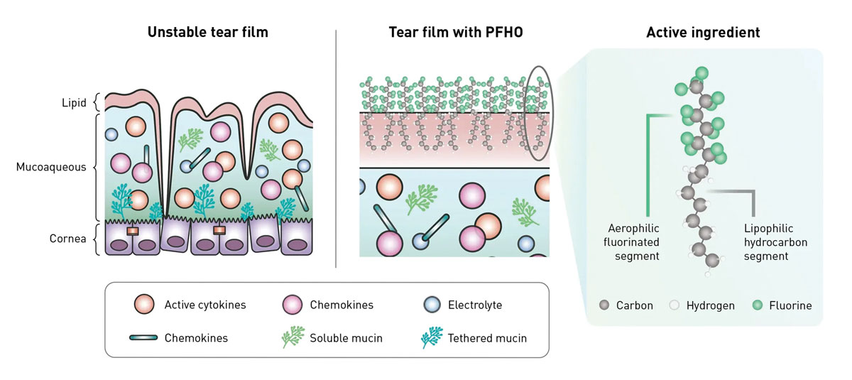 Fig. 3. Perfluorohexyloctane, the active ingredient in Miebo, binds to both air and lipid molecules upon instillation. In this way, it compensates for tear instability due to inadequate lipid secretions by establishing its own barrier.