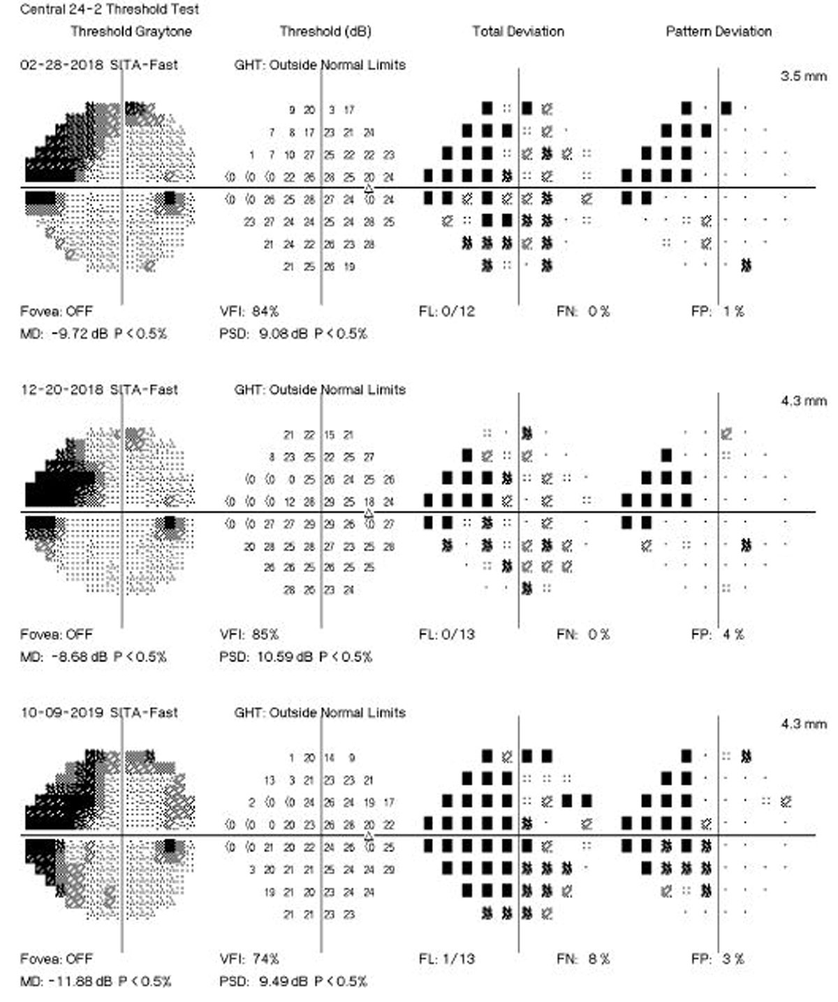 The OHTS trial, spanning 20 years, reveals significant rates of visual field loss in patients at risk for glaucoma despite regular monitoring. The study highlights rapid progression in some eyes, particularly those with visual field POAG. Researchers call for more frequent testing intervals and personalized intraocular pressure (IOP) management to better detect early glaucomatous damage, emphasizing the need for tailored care based on progression rates, patient age and medical history.