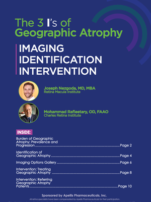 The 3 I's of Geographic Atrophy