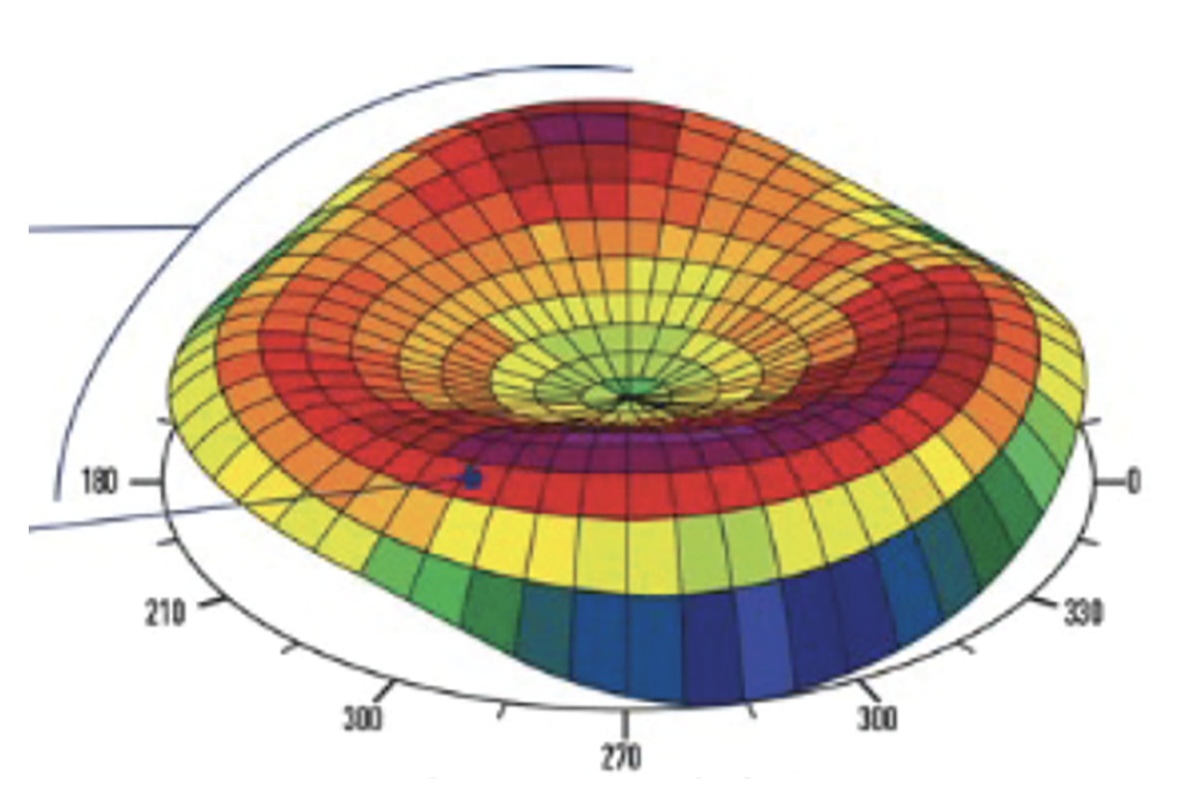 Fig. 1. Contoura Vision’s advanced corneal mapping technology captures 22,000 unique elevation points per eye, creating detailed 3D topographic maps for customized LASIK treatments.