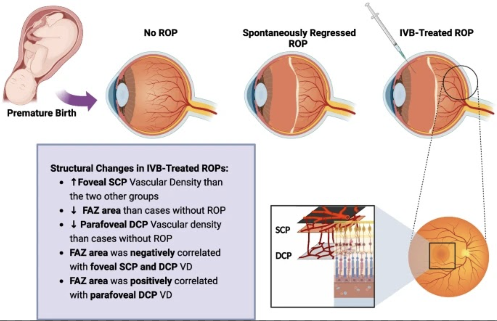 One possible reason for differences in the foveal avascular zone could be due to related ischemia induced by lower parafoveal deep plexus vascular density, leading to pigment epithelial-derived factor and increased VEGF in the foveal region. This would induce greater development and migration of vessels the center of the macula. 